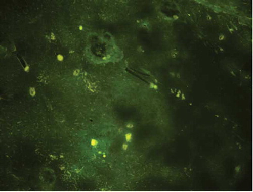 Figure 5. Representative photograph of the kidney after renal injection from inverted fluorescence microscopy (200×) Lentivirus-mediated Col shRNA delivery was performed through injection into renal cortex and green fluorescent protein was determined under an inverted fluorescence microscope which reflects the feasibility of lentivirus-mediated shRNA delivery through renal parenchyma injection.