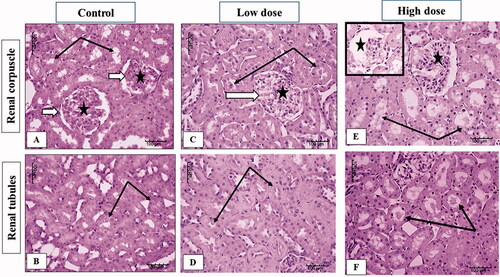 Figure 6. Illustrative photographs displaying the effect of low and high doses (100 and 200 mg/kg, respectively). MgO-zein nanowires on kidney histopathology in male rats (H & E stain × 200). Control group (A,B) showed normal renal corpuscle (white arrow), glomeruli (star), and tubules (black arrows). Low dose group (C,D) showed mild dilation of glomerular capillaries (white arrows and star) and tubules also showed mild dilation. High dose group (E,F) showed focal disorganization or atrophy of glomerular capillaries (stars), and tubules are dilated and contain scanty hyaline material (black arrows).