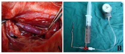 Figure 1 A) Rabbit model of interposition of external jugular vein into the common carotid artery using an end-to-side technique. B) Self-made drug-perfusion device.