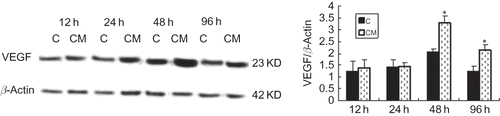 FIGURE 4. Effect of CM on VEGF protein expression. Production of VEGF protein by EPCs in CM group was significantly greater than that in control group and reached the maximum at 48 h. C (control group): conditioned medium from normoxic condition; CM: conditioned medium from hypoxic condition; β-actin was used as a housekeeping protein. Data are presented as the mean ± SD. n = 5. *p < 0.05 compared with control group.