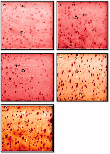 Figure 4. Photomicrographs showing histological changes in cerebral cortex in different groups; control group (A); flesh- and brain-treated groups (B); (C) and liver- and viscera-treated groups (D); (E) several abnormalities (indicated by arrows). (A) Histological picture showing normal cerebral cortex tissue. Hematoxylin and eosin staining, ×400. Display full size: Glial cells. Display full size: Neurones. ↓: Vacuolated cytoplasm. Display full size: Hemorrhage.