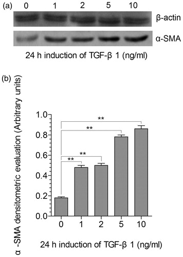 Figure 3. Expression of α-SMA in mesangial cells after TGF-β1 induction. (a) Immunoblotting analysis of α-actin (upper gel) and of α-SMA (lower gel) protein expression 24 h co-culture with different concentrations of TGF-β1 (0, 1, 2, 5, and 10 ng/ml; o as control); (b) Representation of the densitometric intensity band ratio of α-SMA and α-actin that was used as internal control. **stands for p < 0.01.