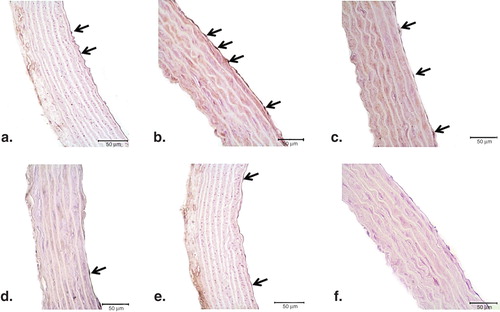 Figure 4. Representative photomicrographs of PARP-1 (a–f) immunohistochemistry in controls (a), ET-1-incubated (b), ET-1 and PEG-SOD plus apocynin-incubated (c), ET-1 and PJ34-incubated (d), and PJ34-incubated vessels (e). Strong immunostaining of PARP-1 was observed in ET-1-incubated endothelial cells (arrows). Expression of PARP-1 was minimal in both ET-1 and PEG-SOD plus apocynin-incubated, and ET-1 and PJ34-incubated vessel endothelium. Negative control sections with PARP-1 (f) primary antibodies. Note the absence of PARP-1 immunostainings. Original magnifications ×50.