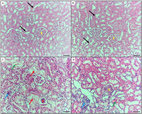 Figure 5. Histopathological changes in the kidney of mice in the different groups. A) Control negative group showing normal features of the kidney; renal convoluted tubules (black arrows), and glomeruli (yellow star). B) Mice treated by gallic acid alone showing normal features of the kidney. C) Mice intoxicated by NiO-NPs only showing extensive renal damage features such as hyaline cast and loss of nuclei in the renal tubules (blue arrow), and shrunken or splitting glomeruli as evident by widened Bowman’s capsule (red star), shrinkage of glomeruli and widening of Bowman’s space (red star), inflammatory cells infiltration (blue arrow), and interstitial hemorrhage (green arrow). D) Mice intoxicated by NiO-NPs and treated gallic acid showing mild renal damage features such as; inflammatory cells infiltration (blue arrow), and interstitial hemorrhage (green arrow). Original magnification 200X, scale bar 50 µm.