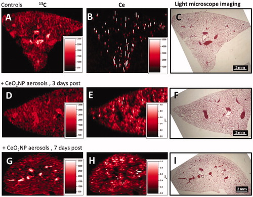 Figure 6. Representative laser ablation inductively coupled plasma mass spectrometry elemental maps (isotopes 13C and 140Ce) and light microscopy images (×12.5) of lung tissues of negative controls (images A–C) and CeO2NP aerosol exposed animals at 3 days (images D–F) and 7 d (images G–I) post-exposure. The light microscope images show the lung tissue section prior to undertaking laser ablation (which destroys the sample) and allow the overall shape and structures such as large airways and larger blood vessels to be seen for comparison purposes.
