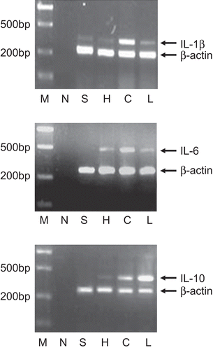 Figure 3.  Effect of two dosage of Da-Cheng-Qi decoction (DCQD) on mRNA expression of IL-1β, IL-6, and IL-10 in severe acute pancreatitis (SAP) rats’ lungs. M: marker, N: the negative control, no cDNAs being added during PCR reaction; S: sham group; H: DCQD (15 g/kg) treatment group; C: control group; L: DCQD (7.5 g/kg) treatment group.