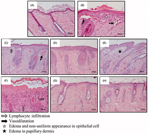 Figure 7. The histological changes of different groups in rat dorsal skin. (A) healthy control, (B) atopy control, (C) BMV-loaded commercial cream, (D) BMV-loaded liposome in gel, (E) BMV-loaded nanoparticle in gel, (F) DFV-loaded commercial cream, (G) DFV-loaded liposome in gel, (H) DFV-loaded nanoparticle in gel.