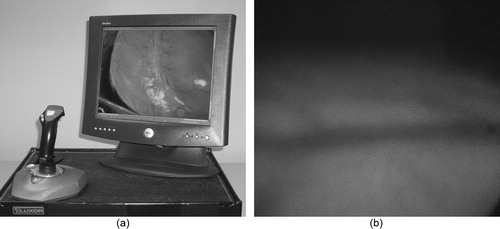 Figure 4. (a) The HeartLander control interface, including the joystick to control locomotion (and eventually therapy), and the monitor to display video from the device camera. (b) View of the left anterior descending artery (LADA) through the device camera. [Color version available online]