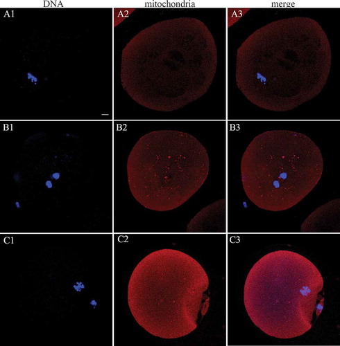 Figure 3. Mitochondrial (red) distribution in human MII oocytes. (A1-3) Peripheral mitochondrial distribution in the MII phase human oocytes in the 37°C group; (B1-3 and C1-3) semiperipheral and diffuse mitochondrial distribution in the RT group, respectively. Scale bar = 10 µm. MII: metaphase II; GV: germinal vesicle; RT: room temperature.
