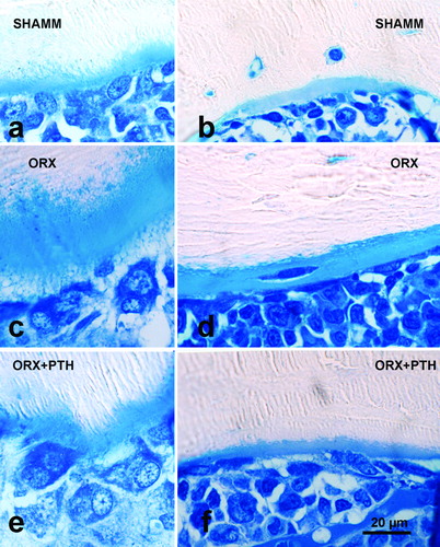 Figure 6.  Lumbar vertebra from male rats. Early bone formation surfaces with cuboidal osteoblasts and osteoid seams (a,c,e) and late bone formation surfaces with elongated osteoblasts and osteoid seams (b,d,f) as shown in 2.5 μm sections stained with toluidine blue. Note that ORX group has wide osteoid seams throughout, but PTH treatment reverses impaired mineralisation.