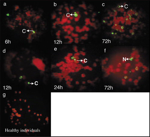 Figure 2 Immunofluorescence staining with 8H8 mab of dengue infected cells. C6/36-HT cells were infected with samples 57 (a–c) and 59 (d–f) from dengue acute patients. At 6 (a), 12 (b), 72 (c) h pi, for sample 57 and 12 (d), 24 (e), 72 (f) h pi for sample 59, the infected cells were reacted 8H8 mab followed with an FITC-conjugated goat anti-mouse antibody and then examined under a fluorescence microscope. Cytoplasmatic and nuclear staining of infected cells is indicated as C and N, respectively. Samples from healthy individuals as negative control (g).