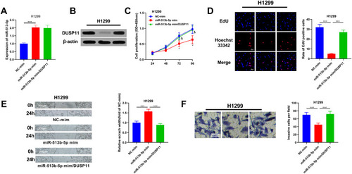 Figure 6 The tumor-suppressive function of miR-513b-5p was partly dependent on its regulatory function on DUSP11. (A) MiR-513b-5p and DUSP11 overexpression plasmids were co-transfected into H1299 cell lines, and the expression of miR-513b-5p in H1299 cells of each group was detected by qRT-PCR. (B) The expression of DUSP11 in H1299 cells was examined by Western blot. (C) CCK-8 method was used to detect the proliferation of H1299 cells after the transfection. (D) EdU assay was performed to examine the proliferation of H1299 cells after the transfection. (E) Wound healing assay was used to detect the migration of H1299 cells. (F) The invasion of H1299 cells was detected by Transwell assay. *, ***Represent P < 0.05, and P < 0.001 respectively. In figure C, &Represents P < 0.05 vs miR-513b-5p mimics group.