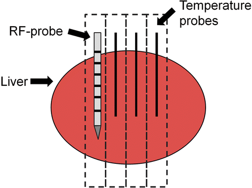 Figure 1. Schematic drawing of the experimental setup used for the ex vivo study. The scattered lines represent the axial CT images that were reconstructed. Distances between RF applicator and temperature probes were 5, 10 and 15 mm, respectively.