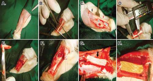 Figure 4. Induction of tendon defect and surgical reconstruction. A. The surgical site and preparation method. B. Skin incision and exposure of the Achilles apparatus. C. Black arrows show the gastroc-soleus muscle proximally and calcaneal tuberosity distally. The red arrow shows the Achilles apparatus, blue arrows show the segment to be removed and the yellow arrow shows the tibialis posterior tendon. D and E. Two centimeters of the Achilles tendon was measured with a digital caliper and removed. F. A modified Kessler Core pattern suture was anchored at the edges of the remaining tendon. G and H. The collagen and collagen-PG implant was inserted.