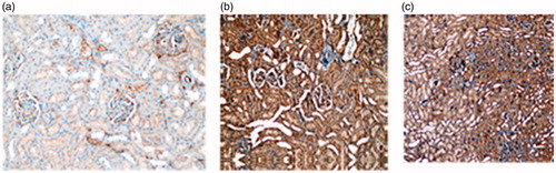 Figure 3. Photomicrographs of theBcl-2 immunohistochemical stained kidneys from (a) control, (b) pre-natal, and (c) post-natal group.