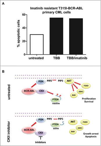 Figure 4. CKII inhibitor promotes apoptosis in T315I-BCR-ABL positive cells. (A) Apoptosis induction of BCR-ABL-T315I bone marrow sample treated with 60 μM TBB and 1 μM Imatinib for 10 hours. (B) Model of the BCR-ABL/CKII/PTEN network in CML.