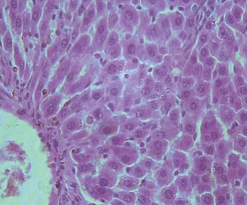Figure 4.  Microphotograph of liver sections taken from rats of F. carica leaves treated group (50 mg/kg, i.p.). H and E staining (× 400).