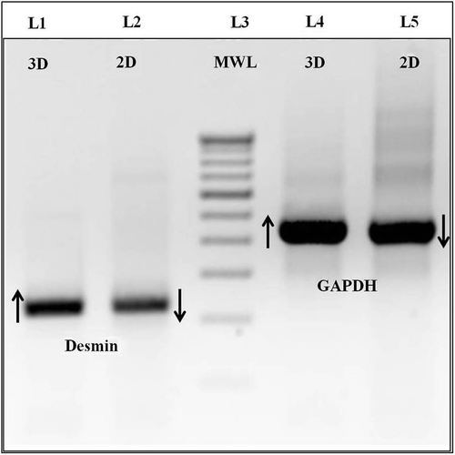 Figure 6. Agarose electrophoresis image of RT-PCR analysis of desmin and GAPDH. (Lanes 1 and 2) – Desmin 3D and 2D. (Lanes 4 and 5) – GAPDH 3D and 2D.