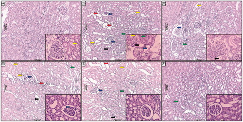 Figure 4. Effect of naringin treatment on APAP-induced pathological alteration in rat kidney. Photomicrograph of sections of kidney of normal (A), APAP controls (B), silymarin (25 mg/kg) treated (C), naringin (40 mg/kg) treated (D), naringin (80 mg/kg) treated (E) and per se treated (F) rats. Glomerular hypertrophy (blue arrow), inflammatory infiltration (black arrow), edema (yellow arrow), congestion (green arrow) and necrosis (red arrow). H&E staining at 40× and 100× (inset).