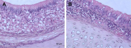 Figure 3 Light photomicrographs of (A) untreated nasal mucosa of rats and (B) rat mucosa treated with in-situ gel containing optimum NF-loaded niosomes.