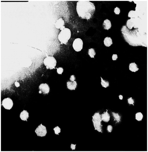 Figure 3. Transmission electron microscopy (TEM) of TP-LE at ×20 000 magnification.