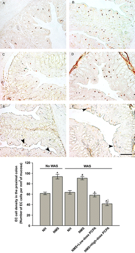 Figure 5.  Representative EC cell staining and statistical analysis of WAS and PCPA on EC cell density in transverse sections of the proximal colon of normal handled (A, NH, n = 6), NMS (B, NMS, n = 8), NH+WAS (C, n = 5), NMS+WAS (D, n = 5), NMS+low-dose PCPA+WAS (E, n = 4), NMS+high-dose PCPA+WAS (F, n = 5) groups. Data are presented as mean ± S.E.M. *P < 0.01 vs. NH group, #P < 0.01 vs. NH+WAS group (t-tests); ▴P < 0.01 vs. NMS+WAS group, †P < 0.01 vs. NMS+low-dose PCPA+WAS group (Bonferroni's correction). Arrow heads indicate EC cells. The scale bar is 100 μm.