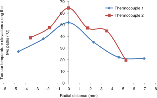 Figure 3. Typical temperature elevation profile in a tumour after steady state. The ferrofluid was injected at the 5 µL/min infusion rate.