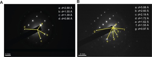 Figure 4 Selected area electron diffraction images in different areas of urinary crystallites in one patient with calcium oxalate stones.Note: (A) patient D, (B) patient A.Abbreviation: d, interplanar spacing.
