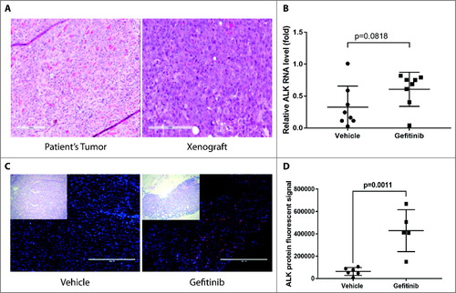 Figure 5. ALK RNA and protein levels increase after gefitinib treatment in HNSCC patient-derived xenografts. Patient-derived tumor cells from patient 10004 were subcutaneously injected into NSG mice. Mice were treated with 100 mg/kg gefitinib or vehicle for 48 hours. A, Morphology of a xenograft tumor and the original patient tumor were shown. B, Quantification of ALK RNA expression after 48 hours of gefitinib treatment. Data represents the mean ± SD (n = 8). C, Immunofluorescent staining of ALK protein (red) and the nucleus (blue) on 10004 patient-derived xenografts treated with gefitinib or vehicle. Scale bar = 400µm D, Data represents the integrated density (positive area x mean fluorescent intensity) of ALK staining in gefitinib treated and vehicle treated mice (n = 5-6).