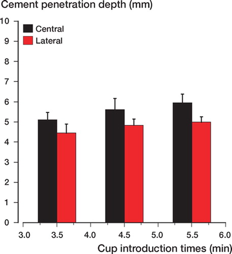 Figure 9. Average cement penetration depth in the central and lateral zones during cup introduction in group 2.