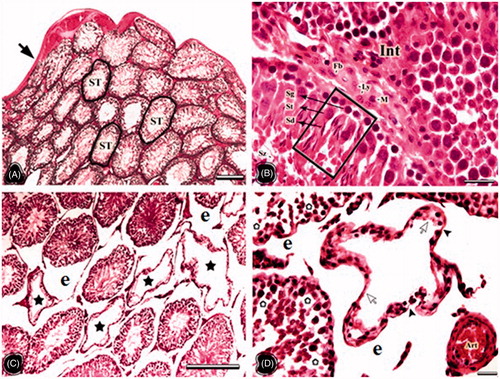 Figure 3. The light microscopical sections of testis belonging to non-obese control (NC) and obese control (OC) groups are shown. (A and B) The light microscopical sections of testis belonging to the NC group. ST: seminiferous tubules, Black arrow: Tunica albuginea, Int: interstitial area, Fb: fibroblast, Ly: Leydig cell, M: macrophage, Framed area: spermatogenic cell series, Sg: spermatogonia, St: spermatocytes, Sd: spermatid, Sz: spermatozoon. (C and D) The light microscopical sections of testis belonging to the OC group. The stars show atrophic seminiferous tubules, asterisks show degenerated spermatogenic cell series, Arrowheads: the thin seminiferous tubule wall, e: enlarged peritubular tissue, Arrows: no spermatogenic cells within tubule epithelium, Art: arteriole. Histological structure of testis is seen in the NC and OC groups. In the OC group degenerations in the seminiferous tubules, enlarged peritubular tissue, and tubular atrophy are important findings. Dye: HE; Scale Bars: (A–C) 250 µm; (B–D) 25 µm.