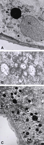 Figure 4 Effects of the oral administration of Hg on the ultrastucture of testis. (A) Microphotography of a tissue section from a control rat that only received deionized water. N: Sertoli cell nucleus, Lys: lysosome, m: mitochondria, tw: tubular wall (6000X). (B) Damaged mitochondria (asterisks) (11500X), (C) Increased number of secondary lysosomes (arrows) and Golgi dilation (asterisks) in sections from rats that received 0.05 μg/ml of Hg for 3 months (5200X).