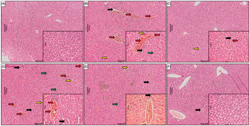 Figure 3. Effect of WRF treatment on APAP-induced pathological alteration in rat liver. Photomicrograph of sections of liver of normal (A), APAP-treated (B), Silymarin (25 mg/kg)-treated (C), WRF (50 mg/kg)-treated (D), WRF (100 mg/kg)-treated (E) and WRF (200 mg/kg)-treated (E) rats. Inflammatory infiltration (red arrow), congestion (yellow arrow), pyknosis (green arrow) and necrosis (black arrow). H&E staining at 40 X and 100 X (inset).