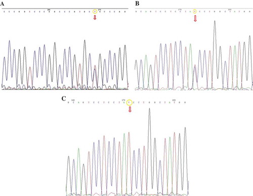 Figure 2. (a) DNA sequencing analysis revealed the C to T transition in the heterozygote form on position 133 of intron 1 of the SOD1 gene (c.72+133C>T). (b) DNA sequencing analysis revealed the c.291C>T genomic alteration (predicting p.Y97Y) in the heterozygote form in the exon 4 of FUS gene. (c) DNA sequencing analysis revealed the c.291C>T genomic alteration (predicting p.Y97Y) in the homozygote form in the exon 4 of FUS gene.