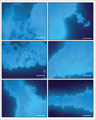 Figure 3. Images of mature biofilms of P. brasiliensis (Pb 18), formed after incubation for 144 h at 37°C 40× magnification. Images were acquired by Fluorescence microscopy and the fungi biofilms were stained by Calcofluor White Stain reagent (Fluka ®). All scale bars are 125 μm.