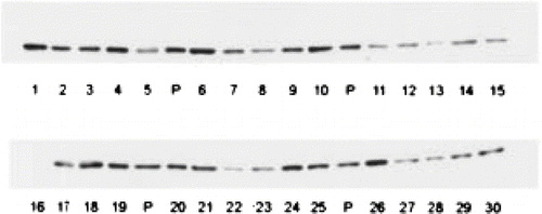 Figure 7 Interindividual variability in human hepatic CYP2E1 content. The illustration is of Western blots of equal protein loading from 30 microsomal samples of human liver, each from a different renal transplant donor, with a highly specific anti-CYP2E1 antibody. Donors had no evidence of liver pathology either histologically or by clinical chemistry. “P” represents a pooled sample used for quality control. (CitationEdwards et al.,1998).