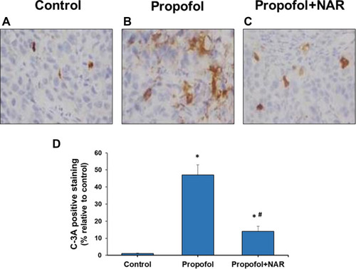 Figure 2 Activated caspase-3 (C-3A) IHC staining in brain cortex slices from neonatal mice. (A) control group; (B) propofol treatment group; (C) propofol+naringenin. (D) Quantitative expression of C-3A positive staining. *P<0.05 values versus control group; #P<0.05 values versus propofol group.