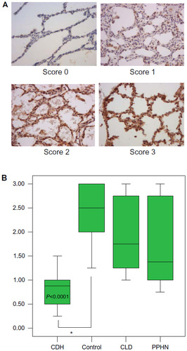 Figure 2 The NGF representative slide-staining (×400) scores (0–3) (A) and the corresponding intensity staining scores (B) at the parenchymal level.