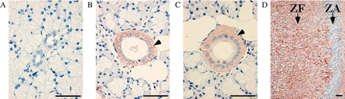Figure 3.  IL-18 expression in pig salivary glands by immunohistochemistry. Results are shown for (A) parotid gland, (B) submandibular gland, and (C) sublingual glands. (D) Adrenal glands were used as a positive control. Arrows indicate zona arcuata and zona fasciculate of adrenal cortex. Arrowheads indicate the ducts of salivary glands with IL-18-positive staining. Each picture is representative of a similar pattern of staining from four different pigs. Bar = 50 μm.