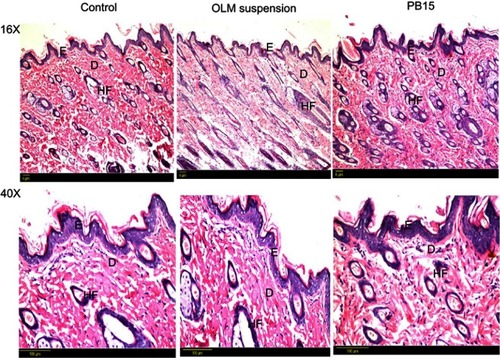 Figure 8 Photomicrographs showing histopathological sections (hematoxylin and eosin stained) of normal untreated rat’s skin (group I), rat’s skin treated with OLM suspension (group II) and rat’s skin treated with PB15 (group III) with magnification power of 16x and 40x, respectively.Abbreviations: E, epidermis; D, dermis; HF, hair follicles; OLM, olmesartan medoxomil; PB, PEGylated bilosome.