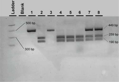 Figure 1 Agarose electrophoresis result of the ARMS2 A69S PCR-RFLP genotyping method.