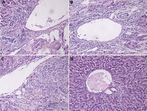 Figure 10 Pathological changes of the donor liver after transplantation.Notes: (A) Liver tissue sections of the saline group. (B) Liver tissue sections of the HGPAE vector group. (C) Liver tissue sections of the pHK/HGPAE complex group. (D) Liver tissue sections of the pMyD88/HGPAE complex group.Abbreviation: HGPAE, histidine-grafted poly(β-amino ester).