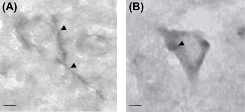Figure 5. Wisteria floribunda agglutinin (WFA) histochemical labeling of chondroitin sulfate proteoglycans (CSPGs) in the human cerebral cortex. (A) CSPG-rich perineuronal nets (arrowheads). (B) WFA also labeled intracellular CSPGs (arrowhead). Scale bars = 5 μm (A and B).