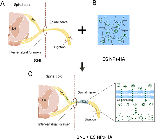Figure 1 Esketamine-encapsulated PLGA nanoparticles topical application diagram. Spinal nerve ligation in mice (A); ES NPs-HA: hydrogel-containing esketamine-encapsulated nanoparticles (B); Spinal nerve root administration (C).