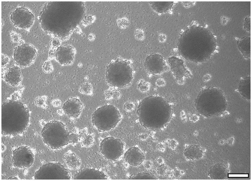 Figure 8. Sphere-forming capacity is seen as a classical characteristic of NCSC-like cells. CD271+ cells were able to form spheres when cultured under non-adherent conditions. After 14 days in culture, the majority of cells started to form spheres. Scale bar, 100 µm.