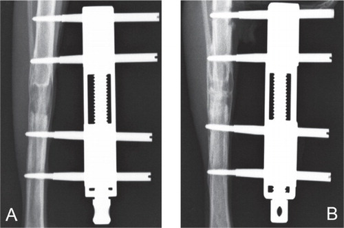 Figure 2. Radiographs of the distracted tibias taken from group R (A) and group I (B). There was significantly higher radio-density in the distracted callus in group I.