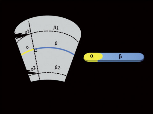 Figure 1. Schematic representation of the muscle damage measurements relative to the midsubstance cross-sectional surface area (MCSA). A relatively large damaged area at the origo (α1) may yield the same percentage of damaged MCSA (α) as a relatively small area at the musculotendinous insertion (α2).