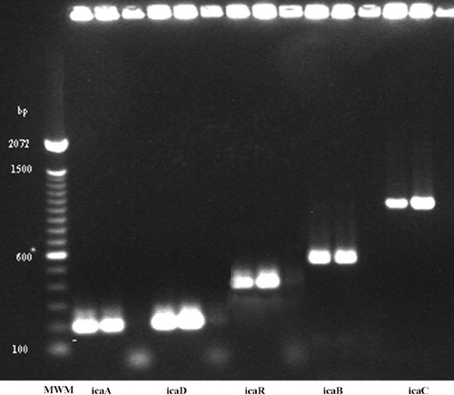 Figure 2. Agarose gel electrophoresis of PCR products. Each PCR run included the reference ATCC 35984 ica-positive strain, and a positive and a negative strain from our collection.