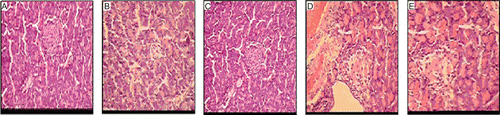 Figure 1.  Photomicrographs of the histology of the mice pancreas. (A) Non-diabetic; (B) Diabetic control; (C) Acarbose (50 mg/kg, p.o.); (D) MUAI (1 mg/kg, p.o.); (E) MUAI (1 mg/kg, p.o.) +2% starch solution.