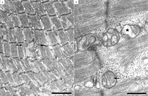 Figure 1. Transmission electron microscopy of the vastus lateralis muscle in patient 1, a 17-year-old pony mare: small round to oval mitochondria line up between the myofibrils (a, arrows); scale 1a = 2 μm. Small mitochondria with few, simple cristae were seen, some presenting with brighter zones in the mitochondrial matrix (b, arrow) and zones with complete disruption of cristae (b, asterisk); scale 1b = 500 nm.
